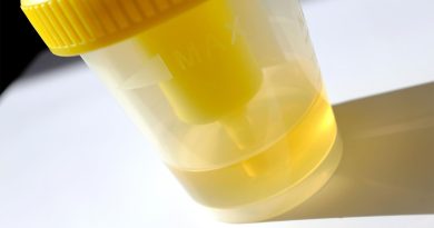 Urine Test Accurately Detected High-Grade Prostate Cancer
