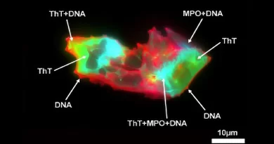 Strange microscopic structures found in Long COVID blood