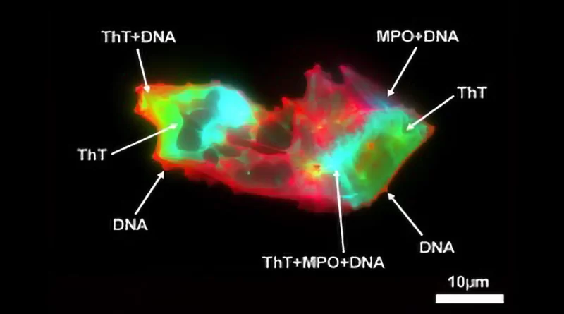 Strange microscopic structures found in Long COVID blood