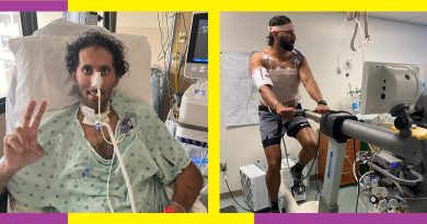 I Survived Breathing Without My Lungs for a Month