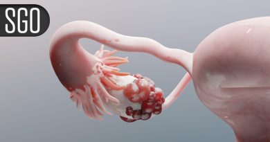 Novel Regimen Boosts Survival for Recurrent Platinum-Resistant Ovarian Cancer