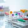 Not just insulin: Early increases in glucagon in type 2 diabetes are linked to fatty liver disease