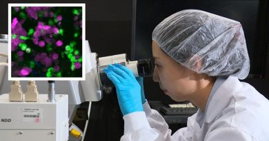 Sydney scientists capture body fighting cancer cells in groundbreaking discovery