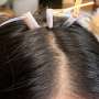 Thermoreversible biogel may solve a hairy problem for wearable brain-monitoring systems Thermoreversible biogel may solve a hairy problem for wearable brain-monitoring systems