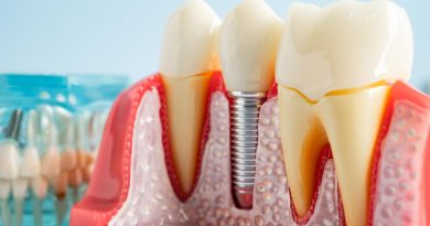 Researchers Solve the Mystery Behind a Billion-Dollar Dental Implant Disease